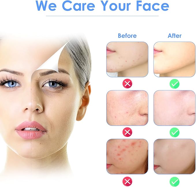 3-in-1 Ultrasonic Facial Skin Scrubber (Original)