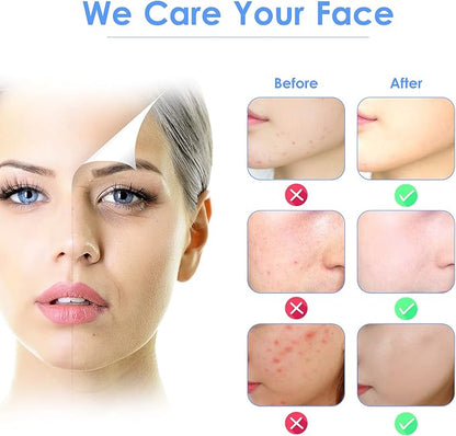 3-in-1 Ultrasonic Facial Skin Scrubber (Original)